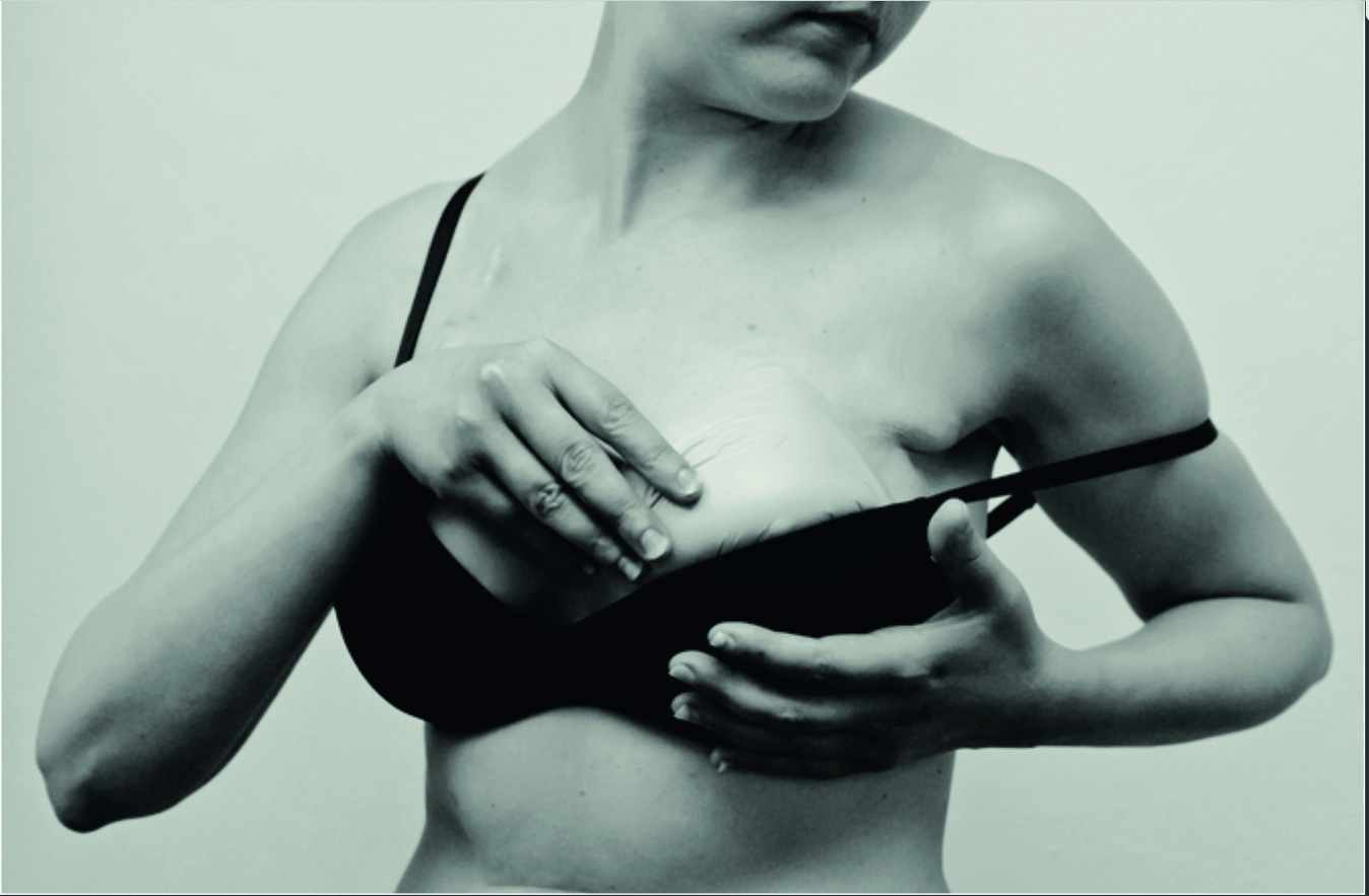 Il cancro a viso aperto